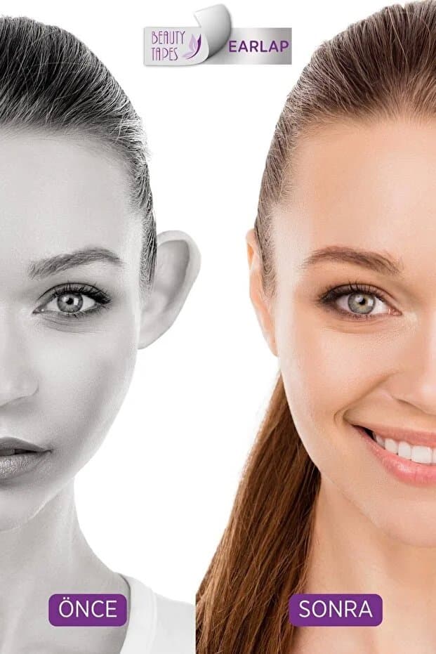 Earlap Kozmetik Kepçe Kulak Düzeltici Bant